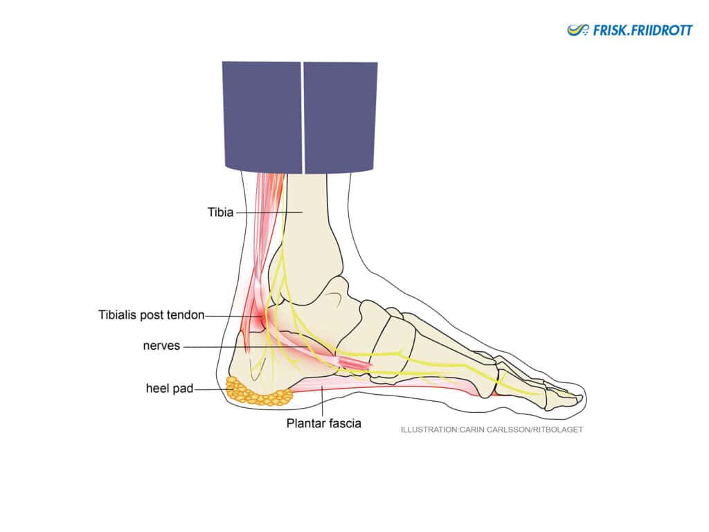 Nerve impingement or tendon dysfunction