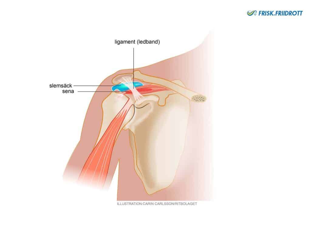 Inklämning (impingement) 